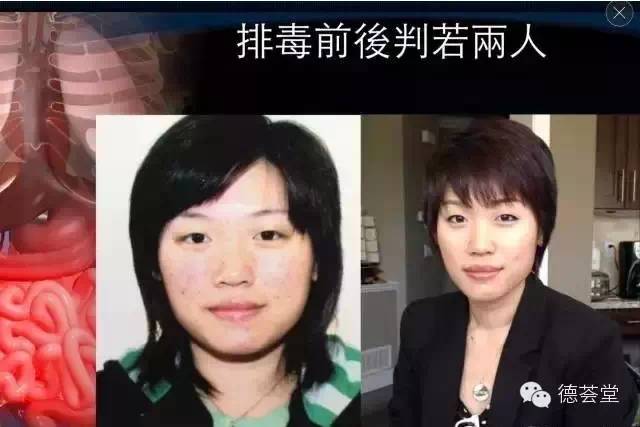 咖啡副灌肠作用大吗_咖啡灌肠的副作用_咖啡灌肠副作用