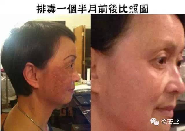 咖啡灌肠副作用_咖啡灌肠的副作用_咖啡副灌肠作用大吗