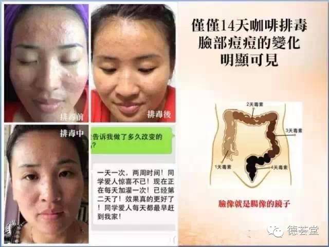 咖啡灌肠副作用_咖啡副灌肠作用大吗_咖啡灌肠的副作用
