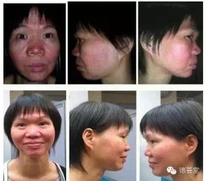 咖啡灌肠的副作用_咖啡副灌肠作用大吗_咖啡灌肠副作用