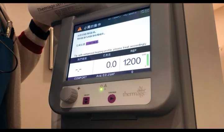 宝宝咖啡斑哭闹会变红吗_宝宝咖啡斑饮食需要注意什么_宝宝咖啡斑图片