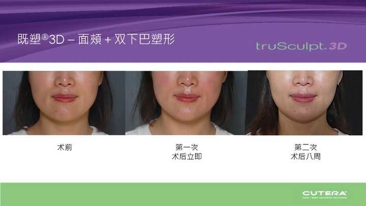 宝宝咖啡斑图片_宝宝咖啡斑哭闹会变红吗_宝宝咖啡斑饮食需要注意什么