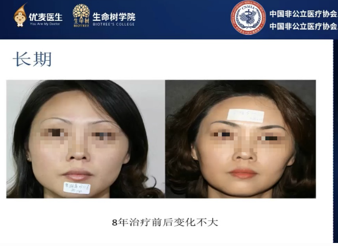 宝宝咖啡斑图片_宝宝咖啡斑饮食需要注意什么_宝宝咖啡斑哭闹会变红吗